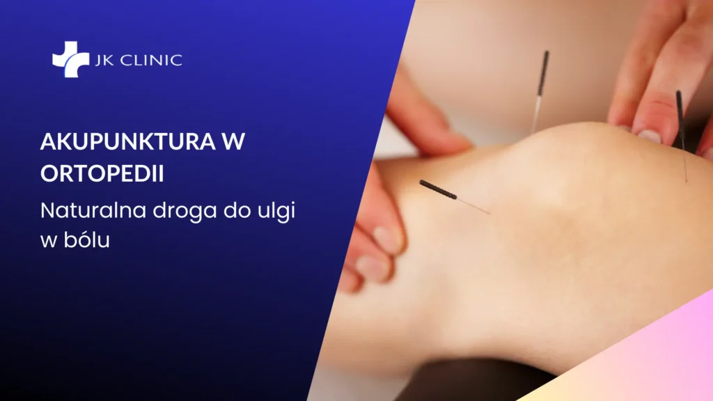 Zabieg akupunktury wykonywany przez specjalistę w JK Clinic Warszawa Wawer – naturalne wsparcie terapii ortopedycznej