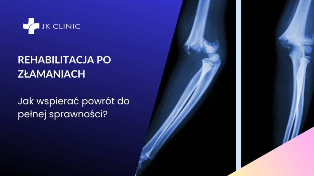 Rehabilitacja po złamaniach – jak wspierać powrót do pełnej sprawności